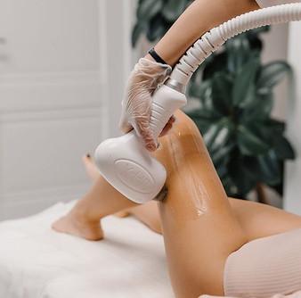 Laser hair removal